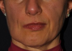 Symmetry of features after surgery.